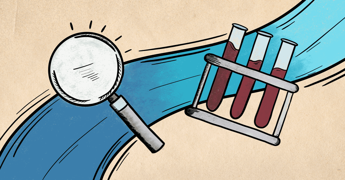 What Blood Tests are Used for Thyroid Eye Disease?