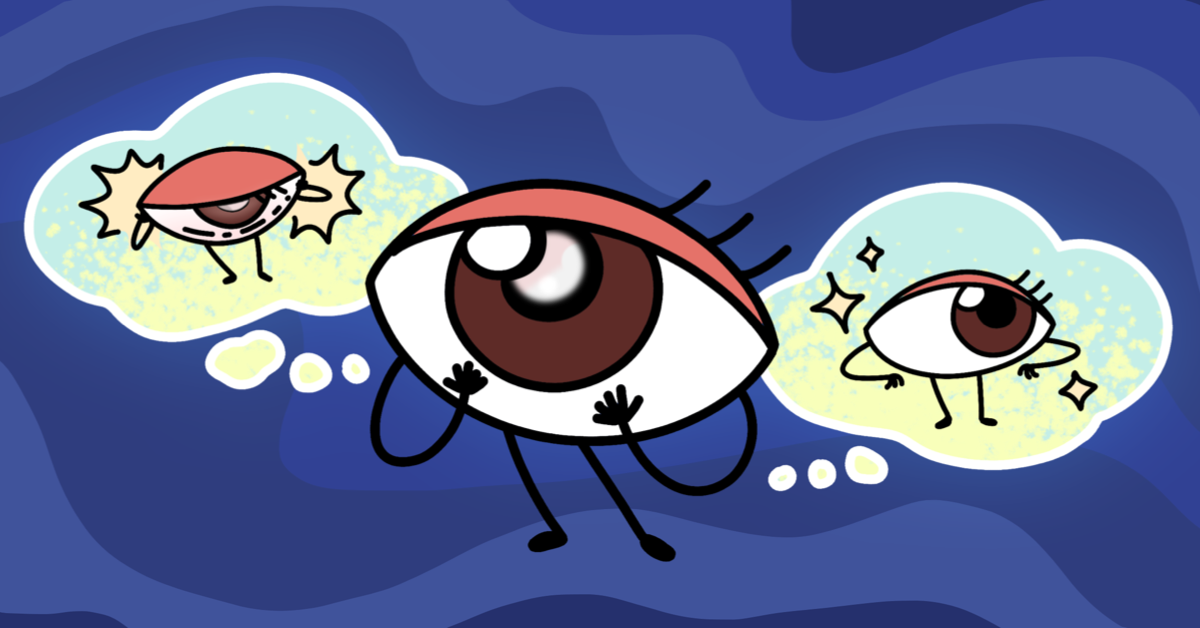 Why I Fear Cataract Surgery Side Effects After Thyroid Eye Disease image
