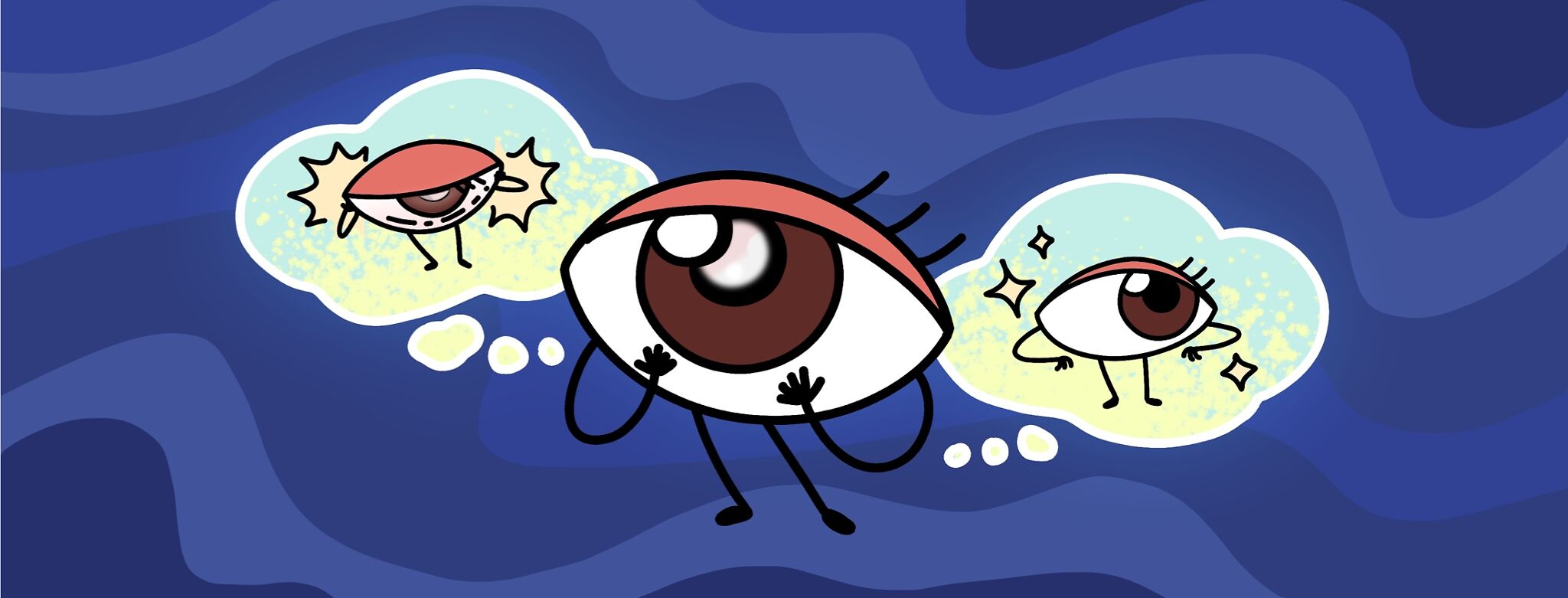 An Illustration of an anthropomorphized partially clouded eyeball with arms and legs with two thought bubbles floating beside it. The left side thought-bubble includes an eye completely clouded by cataracts with pain marks radiating off of it. The right side bubble presents a clear, sparkling eye symbolizing the potential for relief post surgery.